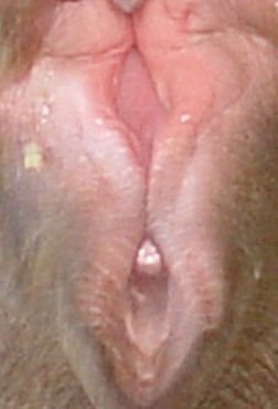 Тест: Какая часть тела изображена на фото?