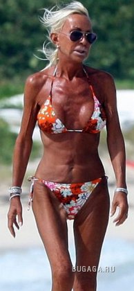 Жертвы пластической хирургии