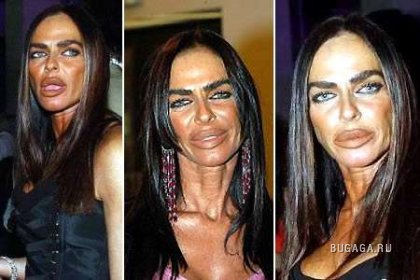 Жертвы пластической хирургии