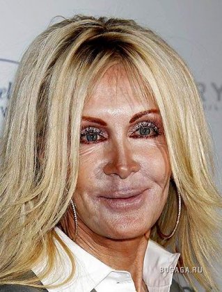 Жертвы пластической хирургии