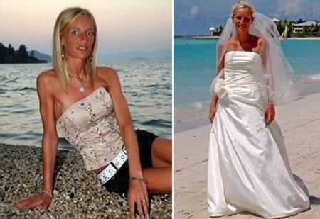 10 самых чудовищных случаев анорексии 10 самых чудовищных случаев анорексии