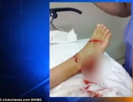 Самые удивительные истории столкновения с акулами Самые удивительные истории столкновения с акулами