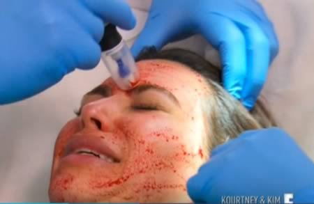 8 Самых жутких процедур для кожи лица