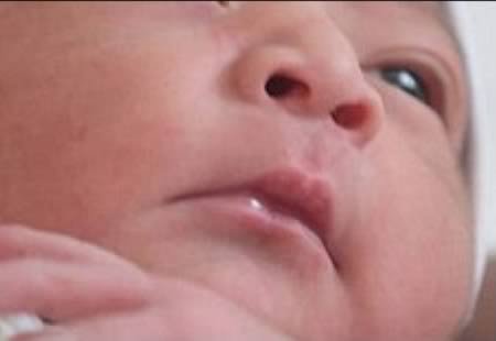 8 Удивительных новорожденных, которые пережили невозможное