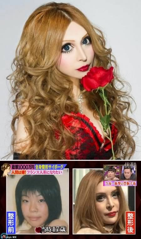 Топ-10: Пластические операции, выполненные для того, чтобы стать на кого-то похожим Топ-10: Пластические операции, выполненные для того, чтобы стать на кого-то похожим