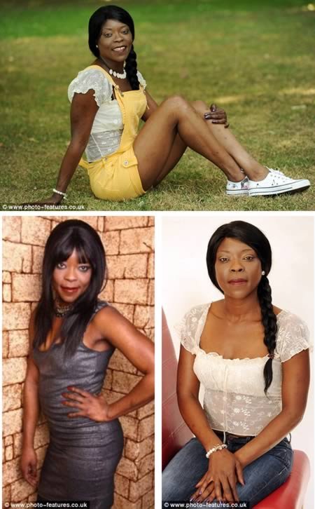 Топ-10: Пластические операции, выполненные для того, чтобы стать на кого-то похожим Топ-10: Пластические операции, выполненные для того, чтобы стать на кого-то похожим