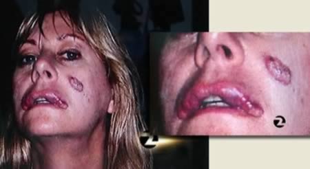 9 Медицинских процедур, которые люди провели на себе самостоятельно из-за отсутствия доступа к медицинской помощи 9 Медицинских процедур, которые люди провели на себе самостоятельно из-за отсутствия доступа к медицинской помощи