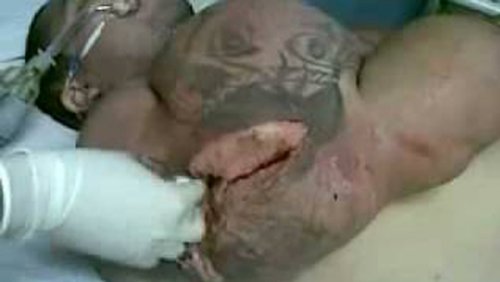 10 шокирующих результатов злоупотребления стероидами