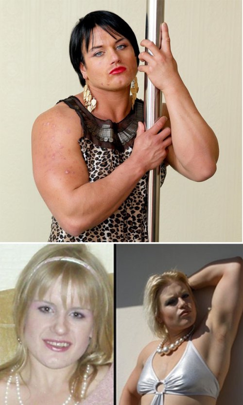 10 шокирующих результатов злоупотребления стероидами