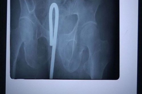 Настоящие рентгеновские снимки, которые шокируют и удивят вас (21 фото)