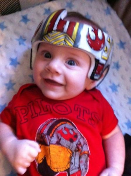 Художница разрисовывает медицинские формирующие шлемы для малышей (26 фото) Художница разрисовывает медицинские формирующие шлемы для малышей (26 фото)