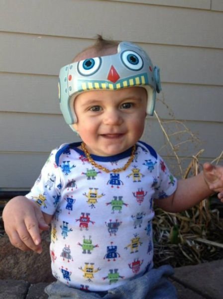 Художница разрисовывает медицинские формирующие шлемы для малышей (26 фото) Художница разрисовывает медицинские формирующие шлемы для малышей (26 фото)