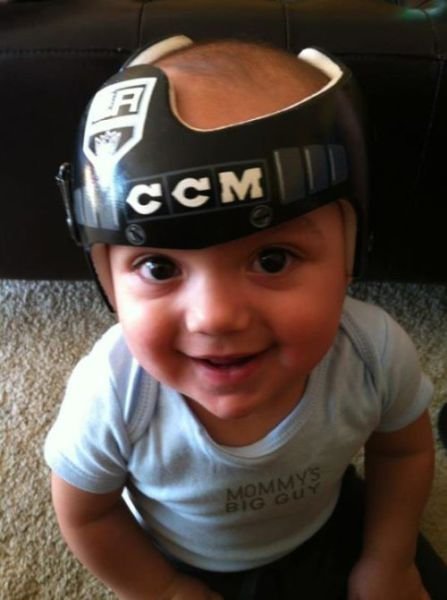 Художница разрисовывает медицинские формирующие шлемы для малышей (26 фото) Художница разрисовывает медицинские формирующие шлемы для малышей (26 фото)