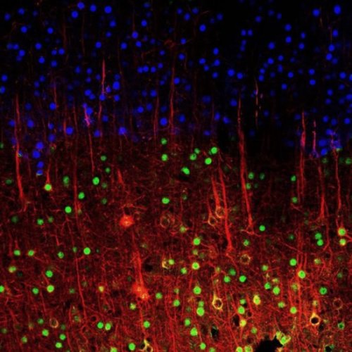 Победители и призёры конкурса микрофотографии от Olympus (25 фото)