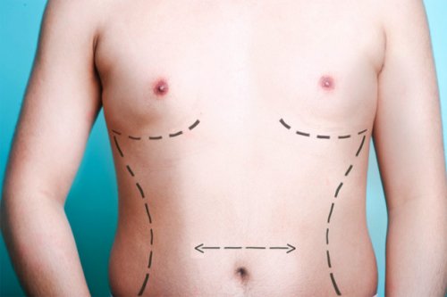 Топ-10 Ужасающих медицинских ошибок, случившихся с пациентами