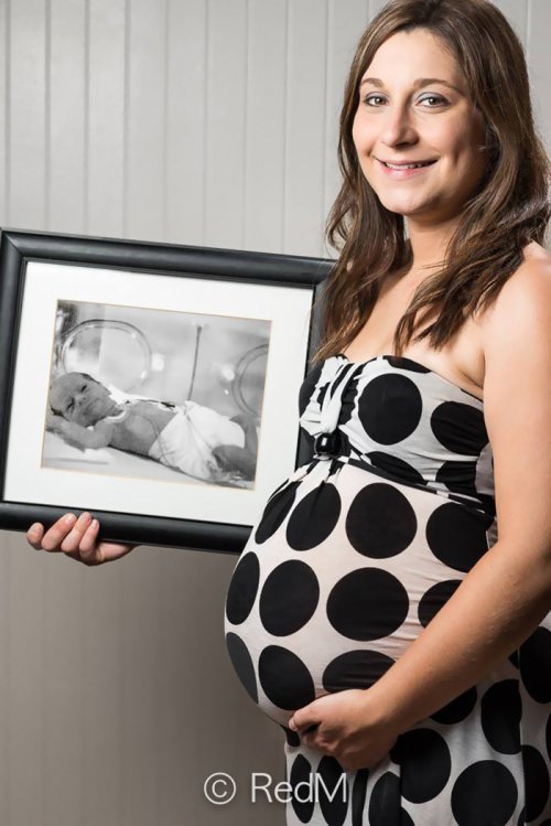 Мощная фотосерия "Les Premas" Реда Мето о недоношенных младенцах (15 фото)