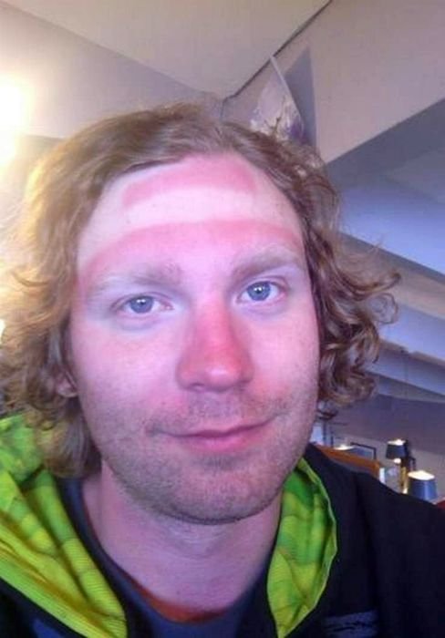 Неудачный загар, который поднимет настроение всем, кроме его обладателей (14 фото) Неудачный загар, который поднимет настроение всем, кроме его обладателей (14 фото)