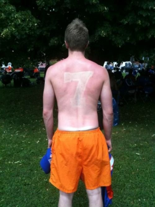 Неудачный загар, который поднимет настроение всем, кроме его обладателей (14 фото) Неудачный загар, который поднимет настроение всем, кроме его обладателей (14 фото)