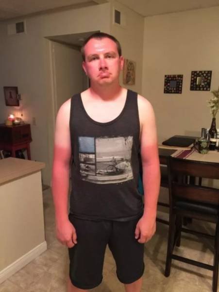 Неудачный загар, который поднимет настроение всем, кроме его обладателей (17 фото) Неудачный загар, который поднимет настроение всем, кроме его обладателей (17 фото)