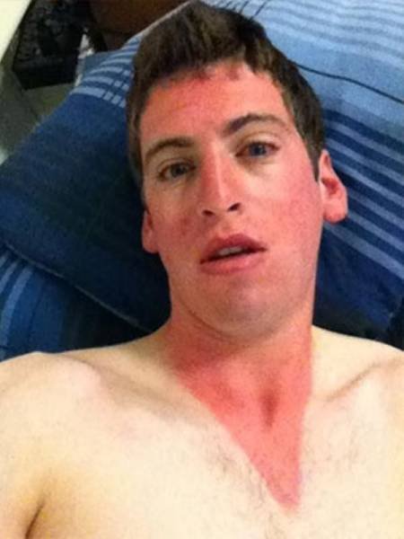 Неудачный загар, который поднимет настроение всем, кроме его обладателей (17 фото) Неудачный загар, который поднимет настроение всем, кроме его обладателей (17 фото)