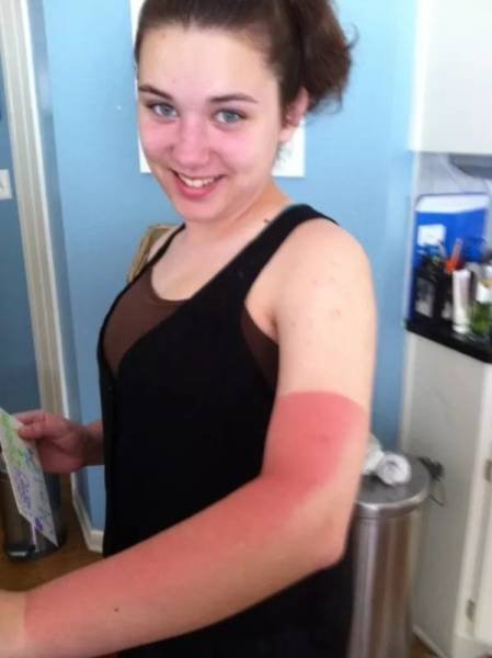 Неудачный загар, который поднимет настроение всем, кроме его обладателей (17 фото) Неудачный загар, который поднимет настроение всем, кроме его обладателей (17 фото)