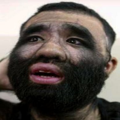 Самый волосатый человек Китая